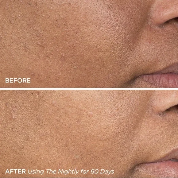 139. BeautyBio The Nightly Overnight Retinol Repair Serum- firm, fade and smooth